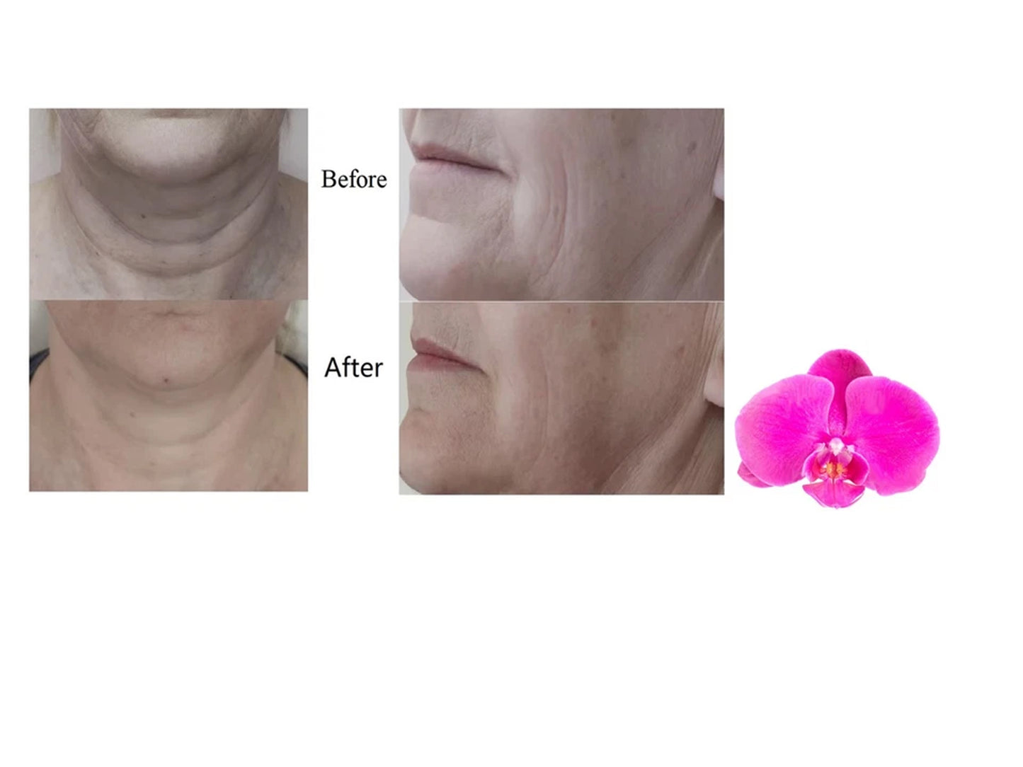 Bio Lift Micro Current Facial Machine Magic Hands Device Spa Equipment Professional